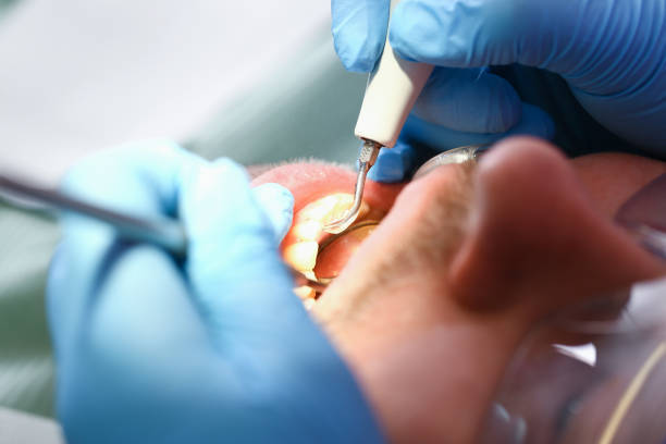 Best Emergency Dental Care for Abscessed Tooth in Red Bluff, CA