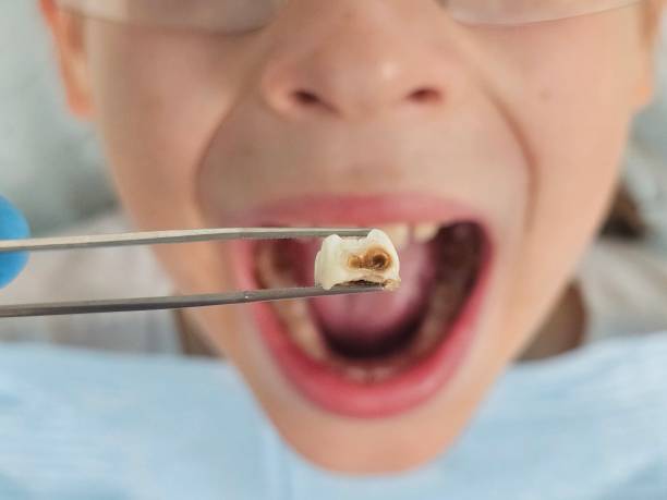 Best Mobile Emergency Dentist in Red Bluff, CA